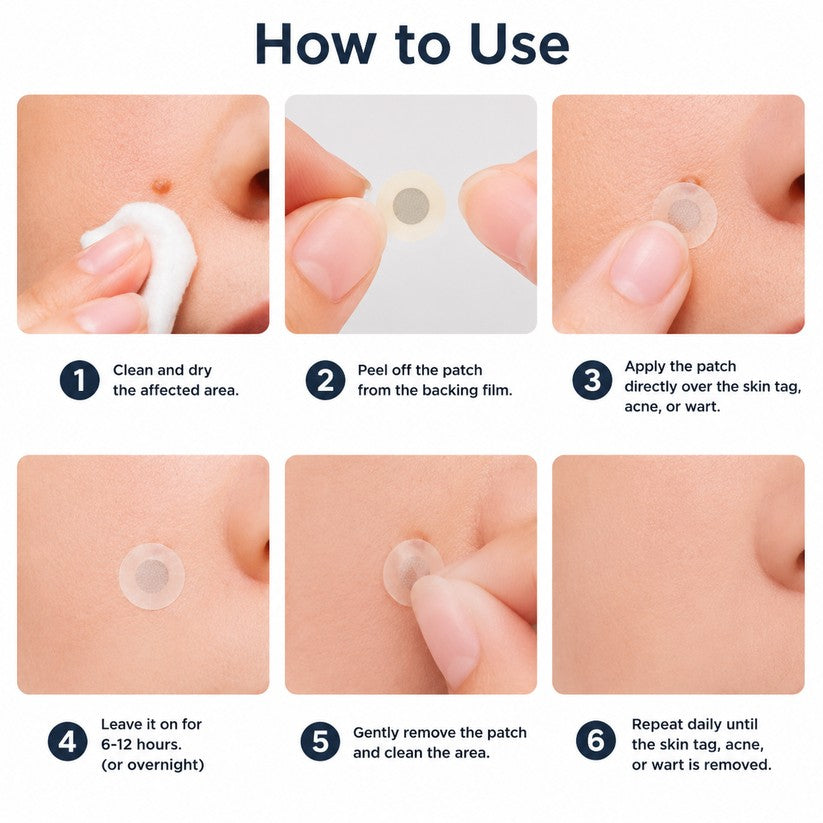🔥GFOUK® 2-in-1 Microneedle & Hydrocolloid Patch🍀 | Removes raised moles, acne, flat warts, and skin tags | Helps improve wrinkles, scars, and blemishes | Invisible patches for face and body