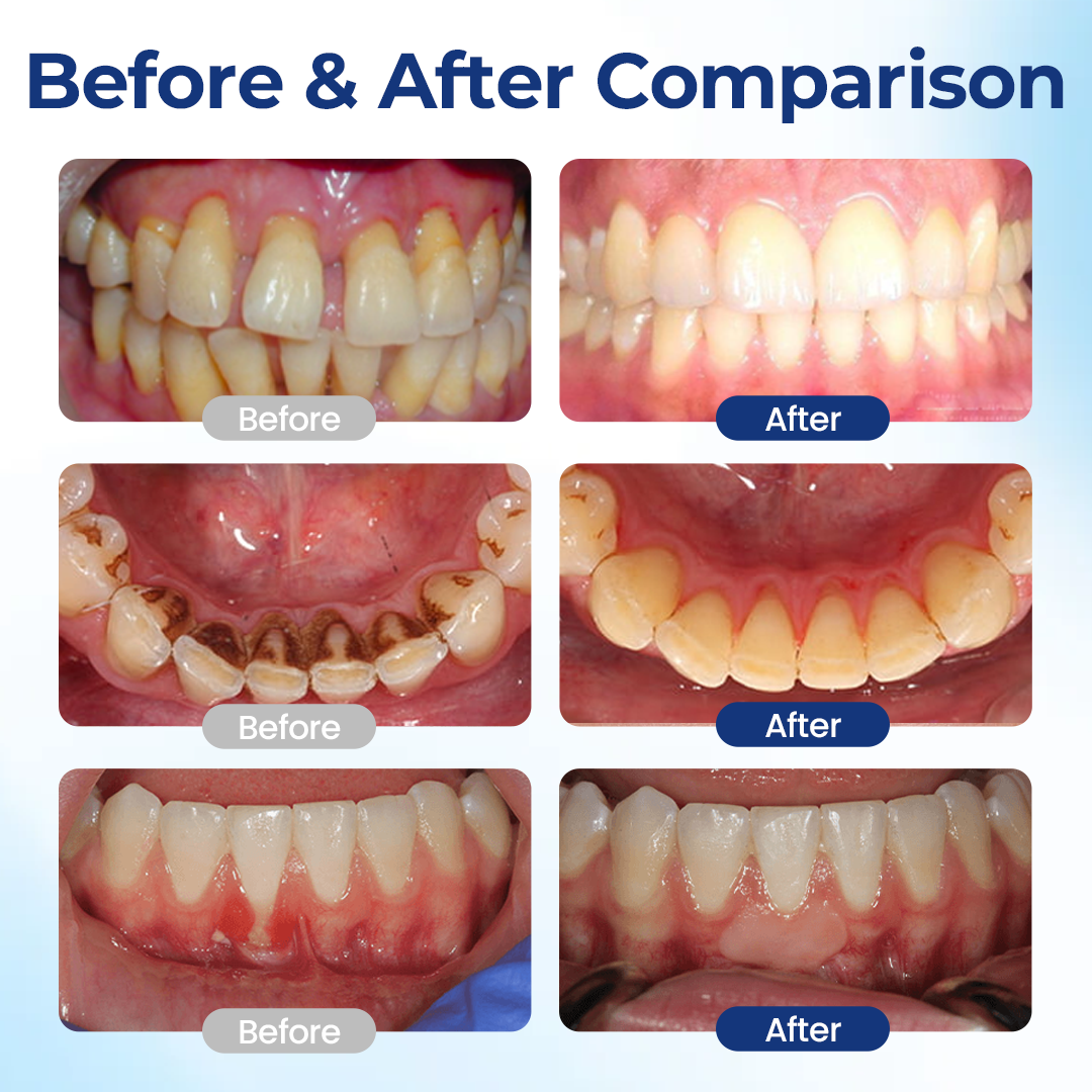 Evolvion™ BeeTakt Oral Repair Solution