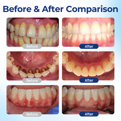 Evolvion™ BeeTakt Oral Repair Solution