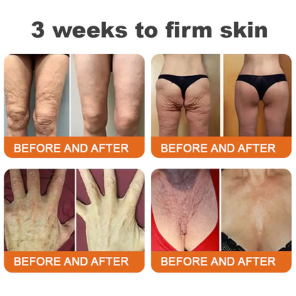 Rolimey® Bee venom Pro Comprehensive Cream —Tightening for Skin Types 🔥