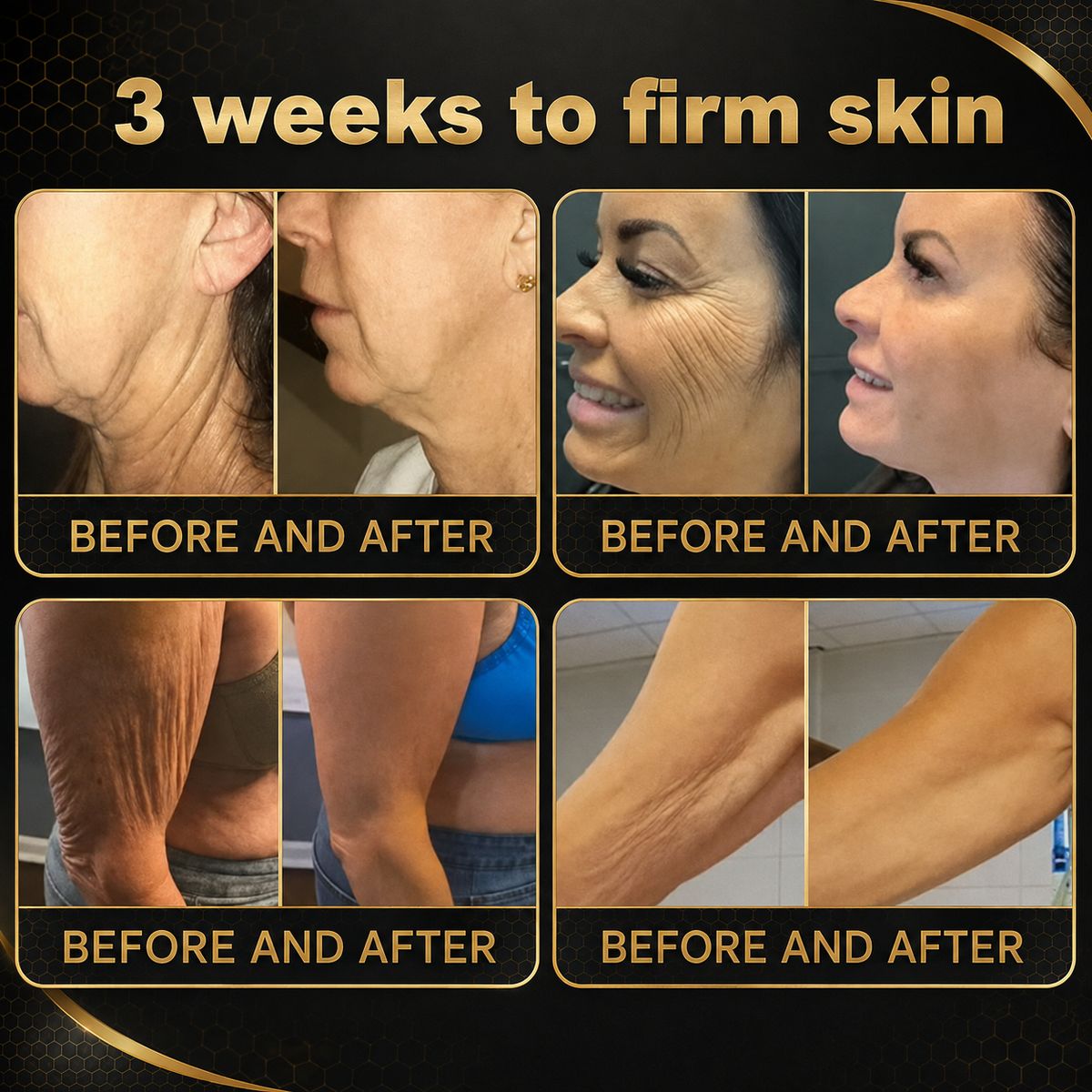 Rolimey® Bee venom Pro Comprehensive Cream —Tightening for Skin Types 🔥
