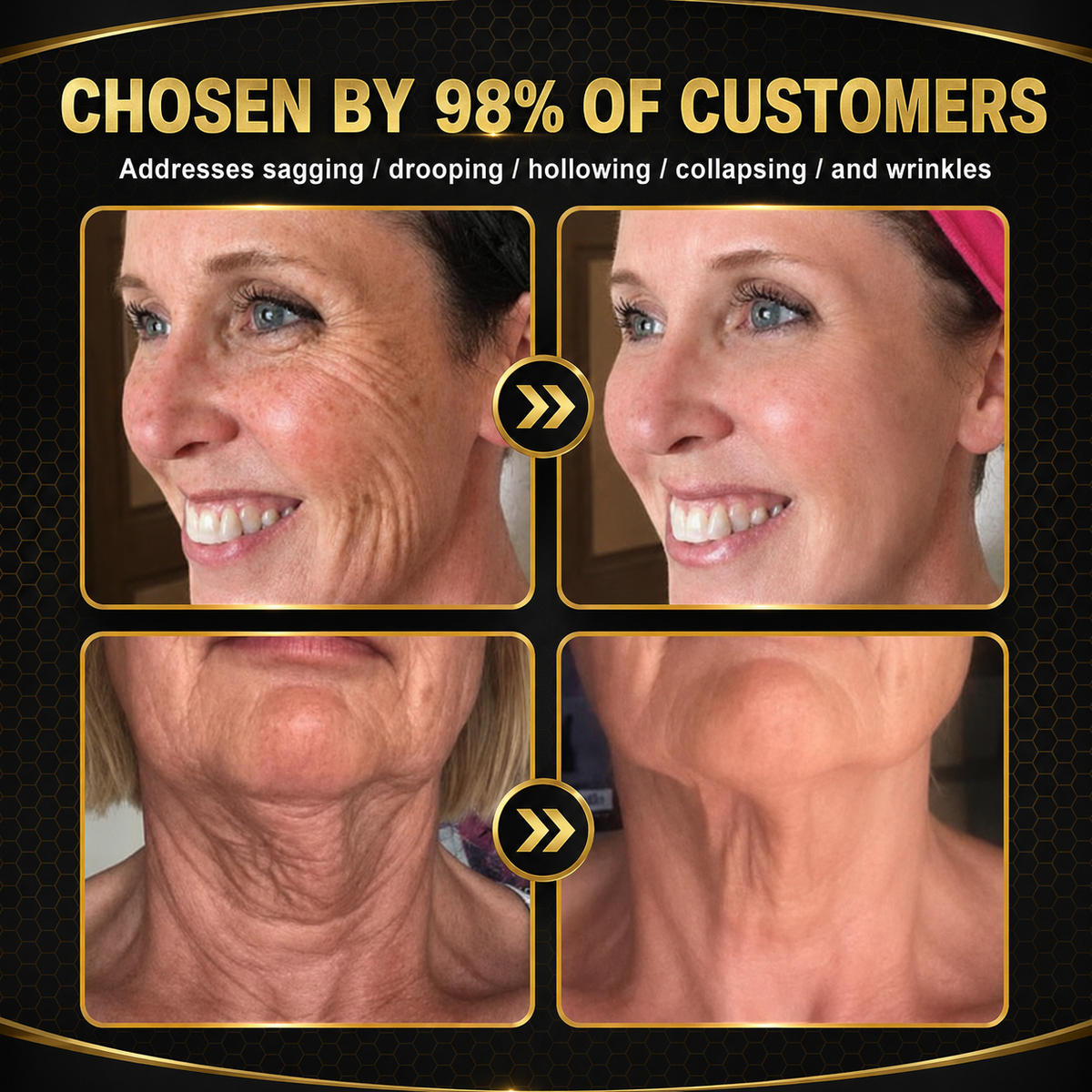 Rolimey® Bee venom Pro Comprehensive Cream —Tightening for Skin Types 🔥