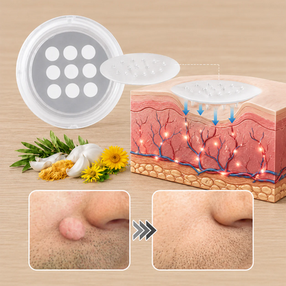 🔥GFOUK® 2-in-1 Microneedle & Hydrocolloid Patch🍀 | Removes raised moles, acne, flat warts, and skin tags | Helps improve wrinkles, scars, and blemishes | Invisible patches for face and body