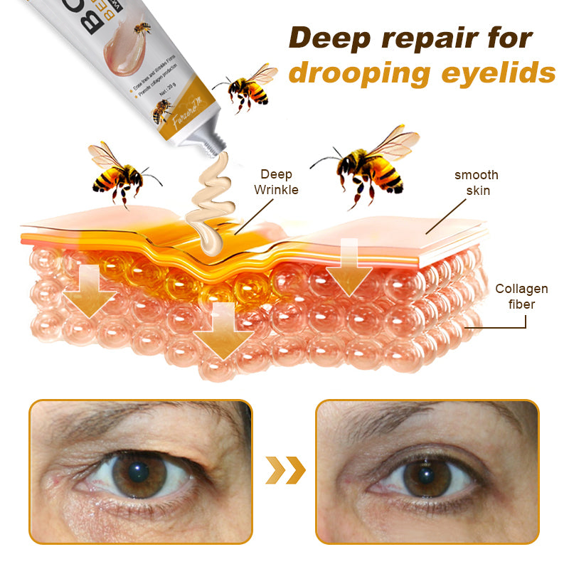 🐝✨ Made and Shipped from UK ✅ Furzero™ Botox Bee Venom Wrinkle Removal Cream - LAST DAY 70% OFF