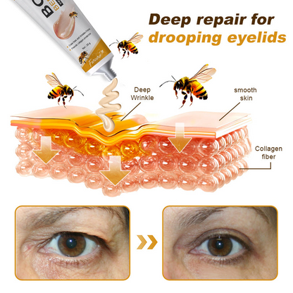 🐝✨ Made and Shipped from UK ✅ Furzero™ Botox Bee Venom Wrinkle Removal Cream - LAST DAY 70% OFF