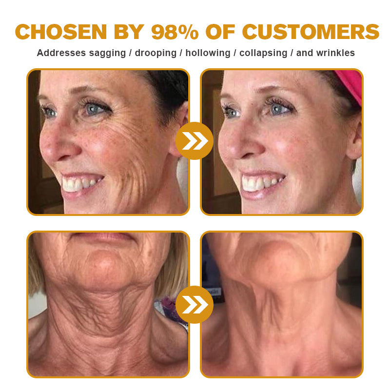 🐝✨ Made and Shipped from UK ✅ Furzero™ Botox Bee Venom Wrinkle Removal Cream - LAST DAY 70% OFF