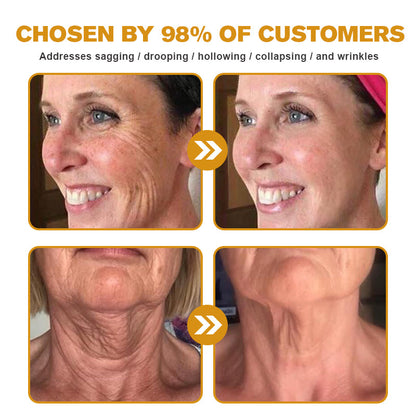 🐝✨ Made and Shipped from UK ✅ Furzero™ Botox Bee Venom Wrinkle Removal Cream - LAST DAY 70% OFF