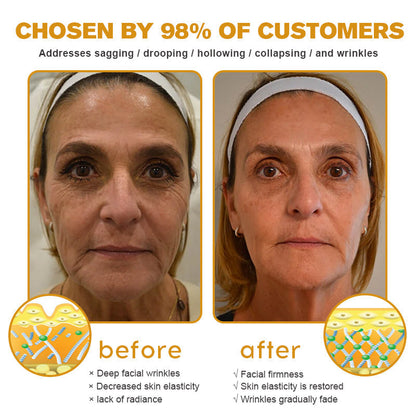 🐝✨ Made and Shipped from UK ✅ Furzero™ Botox Bee Venom Wrinkle Removal Cream - LAST DAY 70% OFF